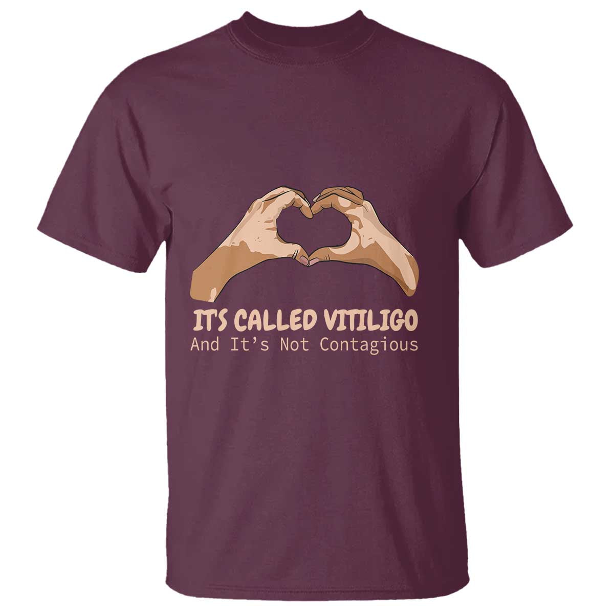 vitiligo-awareness-t-shirt-its-called-vitiligo-and-its-not-contagious