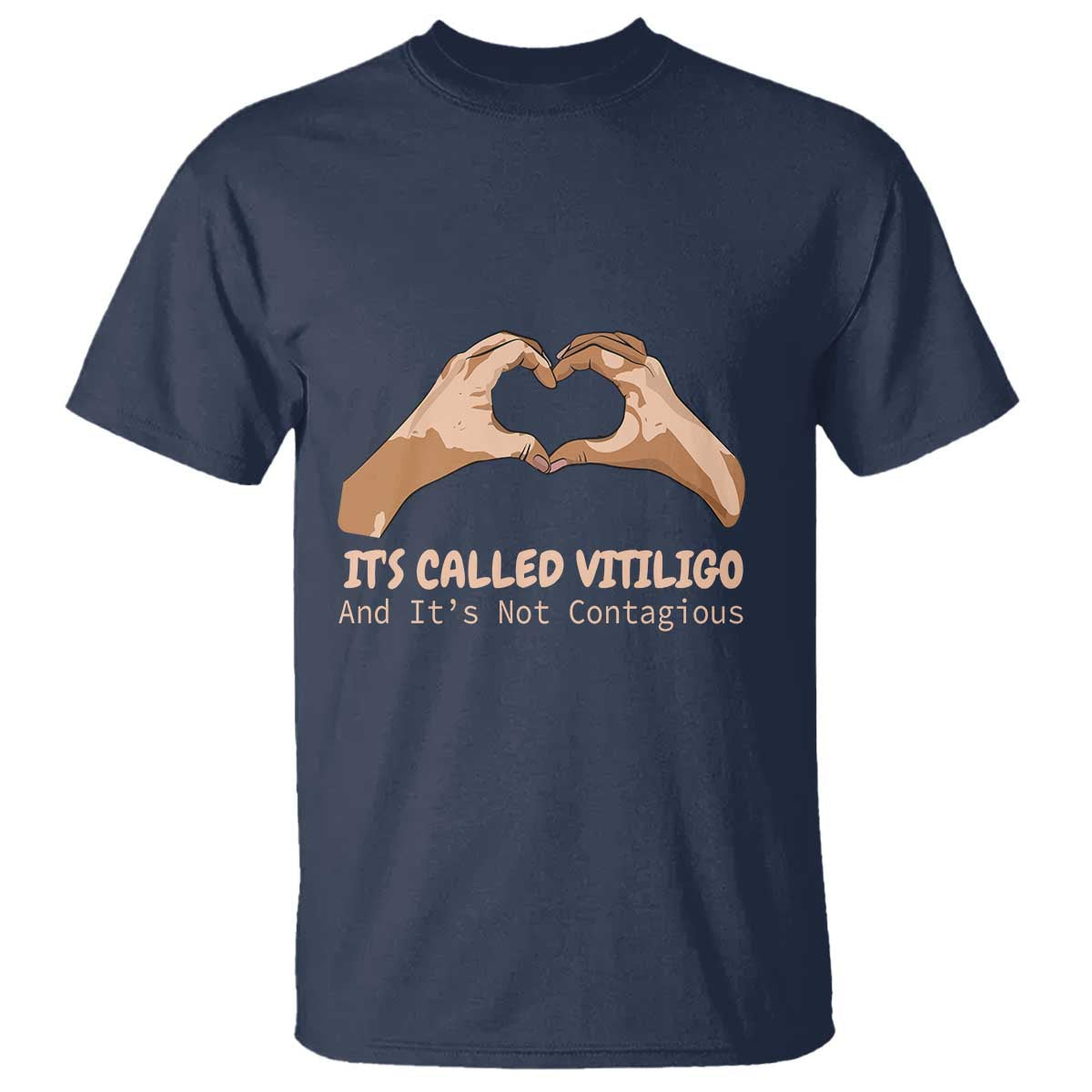 vitiligo-awareness-t-shirt-its-called-vitiligo-and-its-not-contagious