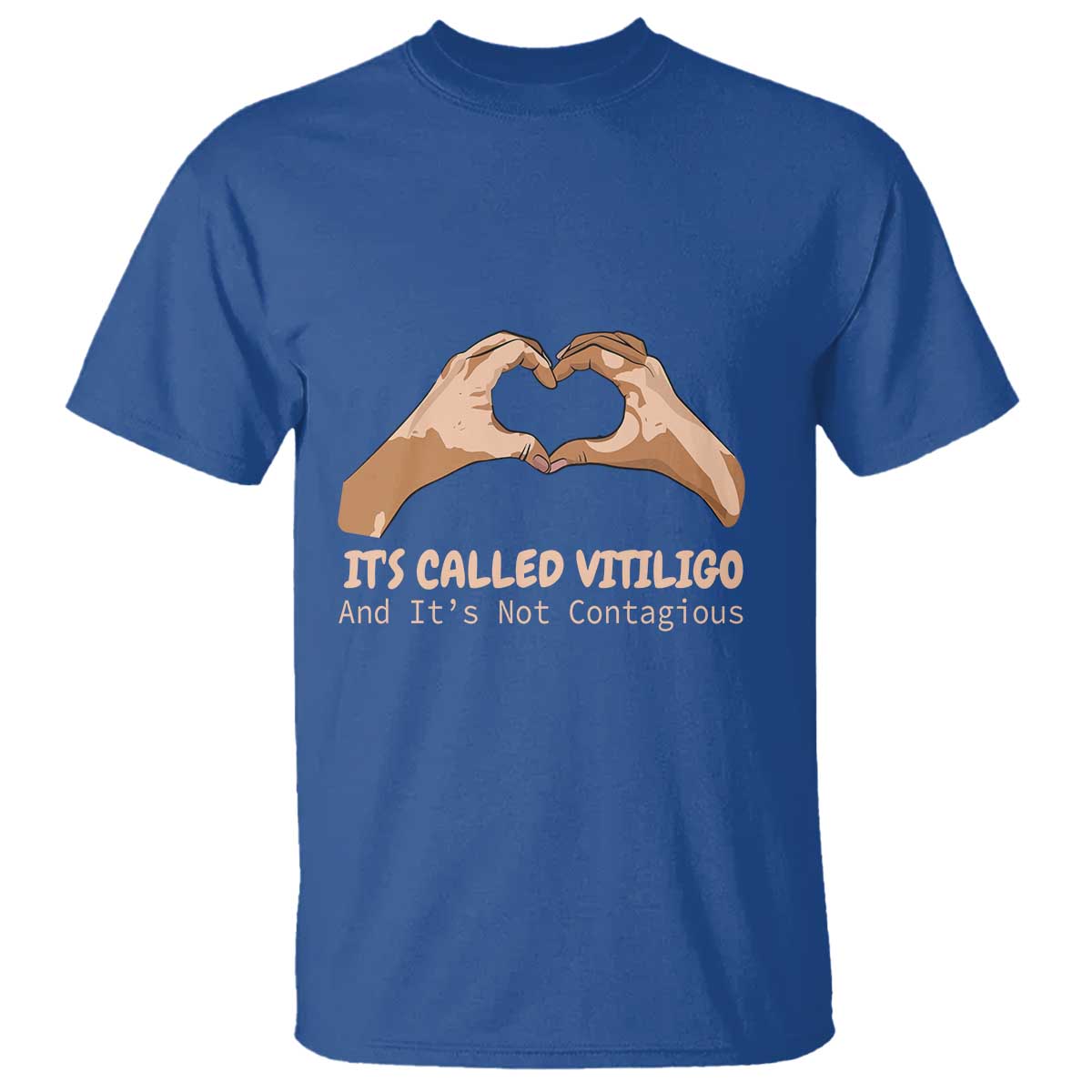 vitiligo-awareness-t-shirt-its-called-vitiligo-and-its-not-contagious